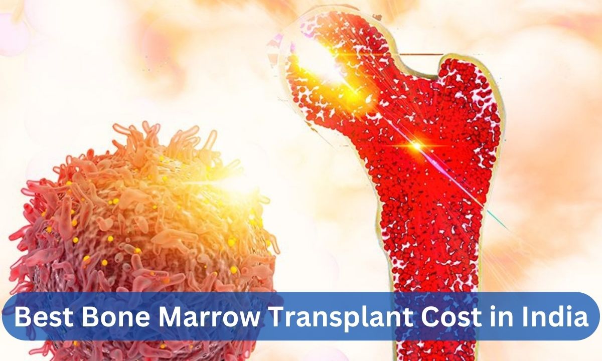 Affordable Bone Marrow Transplant Cost in India