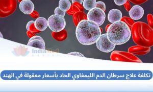 Affordable Acute Lymphocytic Leukemia Treatment Cost in India Arabic