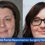 Affordable Facial Reanimation Surgery Cost in India