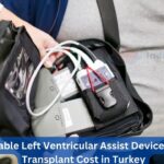 Affordable Left Ventricular Assist Device LVAD Transplant Cost in Turkey