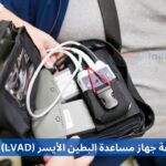 Affordable Left Ventricular Assist Device LVAD Transplant Cost in Turkey arabic