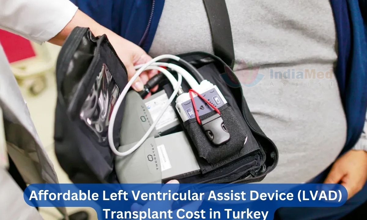 Affordable Left Ventricular Assist Device (LVAD) Transplant Cost in Turkey