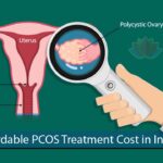 Affordable PCOS Treatment Cost in India