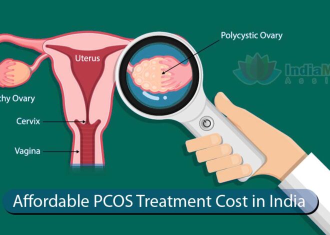 Affordable PCOS Treatment Cost in India