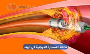 Affordable Rotational Angioplasty Cost in India Arabic