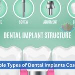 Affordable Types of Dental Implants Cost in India