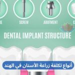 Affordable Types of Dental Implants Cost in India arabic