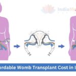 Affordable Womb Transplant Cost in India