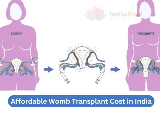 Affordable Womb Transplant Cost in India