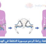 Affordable Womb Transplant Cost in India arabic