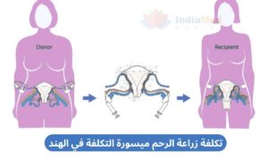 Affordable Womb Transplant Cost in India arabic