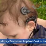 Auditory Brainstem Implant Cost in India