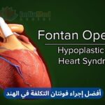 Best Cost Fontan Procedure in India Arabic