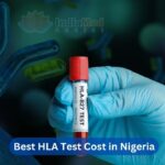 Best HLA Test Cost in Nigeria