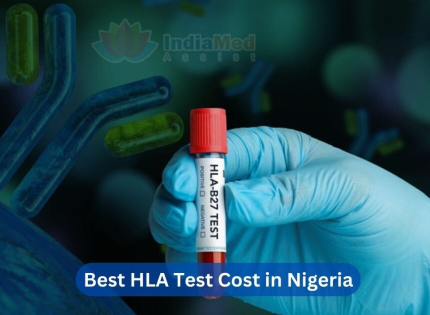 Best HLA Test Cost in Nigeria