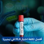 Best HLA Test Cost in Nigeria Arabic