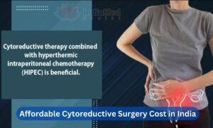 Cytoreductive Surgery Cost in India