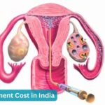IUI Treatment Cost in India