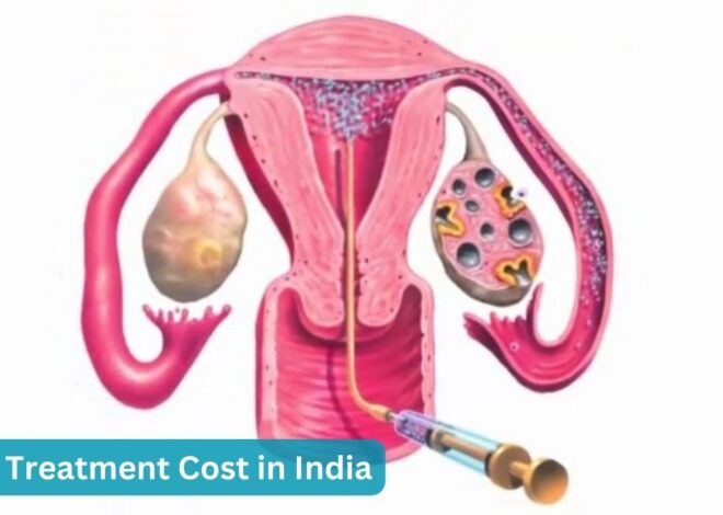 Affordable IUI Treatment Cost in India