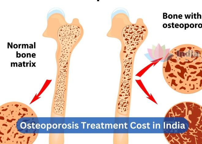 Affordable Osteoporosis Treatment Cost in India