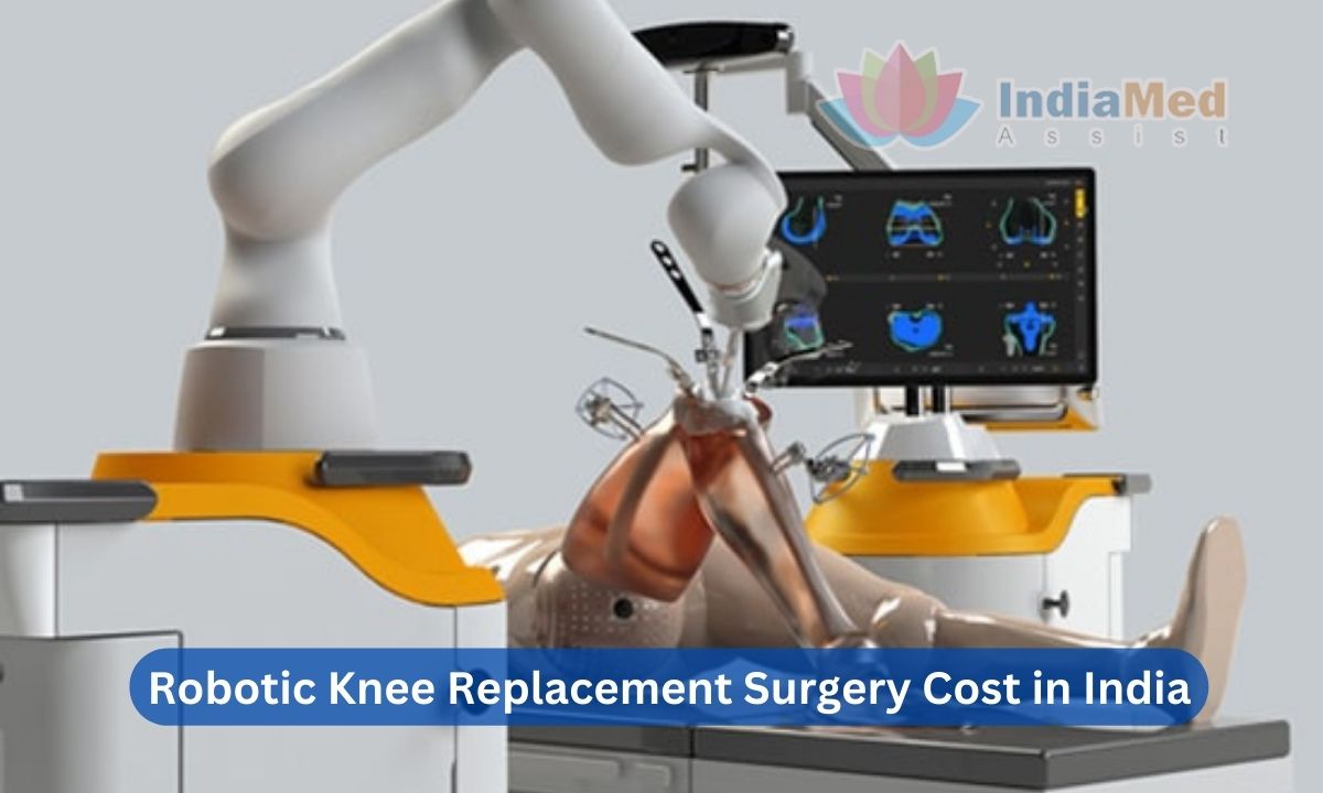 Affordable Robotic Knee Replacement Surgery Cost in India